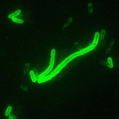Pictured: mycoplasma extremicum, a.k.a. the Mountain Dew-monia virus